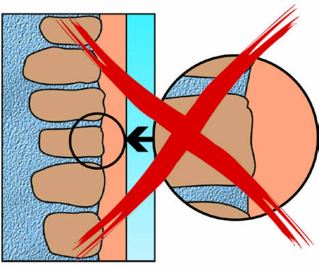 Dégarnissage des joints 2